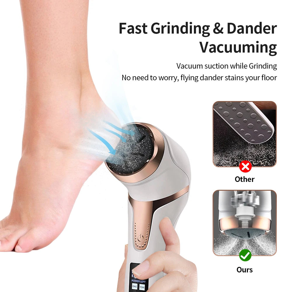 Electric Foot Callous Remover 3 Grinding Heads Waterproof Portable File Dead Hard Cracked Dry Skin Pedicure Tools Rechargeable