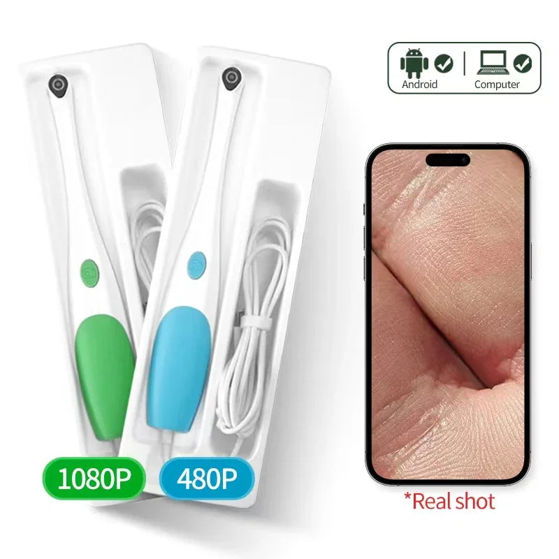 HD Android Apple Visual Mirror Examination 2-In-1 Camera Waterproof Skin Healthy Detecting Cameras For Dentist Observatispection