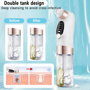 Blackhead Remover Pore Vacuum Face Cleaner Electric Pimple Acne Black Head Removal USB Rechargeable Water Cycle Black Dot Remove - Stereotech