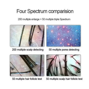 2024 HD Digital Skin Analyzer Professional Hair Scalp Camera Detector Hair Follicle Oil Moisture Test Device 15inch